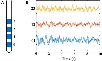 Gamma Oscillations and Coherence Are Weaker in the Dorsomedial Subregion of STN in Parkinson's Disease